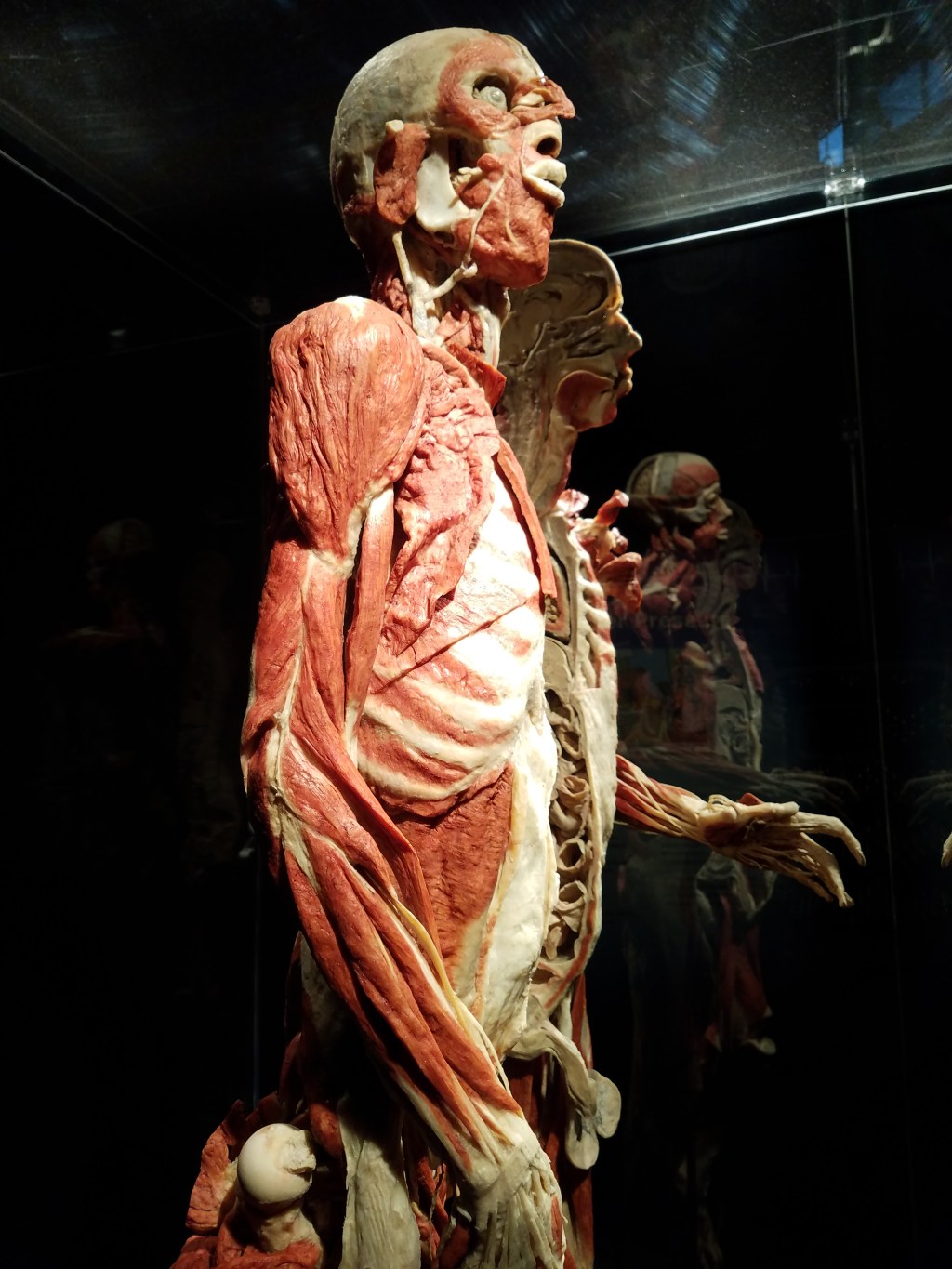 Body Worlds Exhibit&nbsp;Worldwide